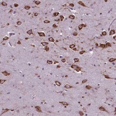 Immunohistochemistry-Paraffin: WDR83OS Antibody [NBP2-55905] - Staining of human hippocampus shows strong cytoplasmic positivity in neuronal cells.