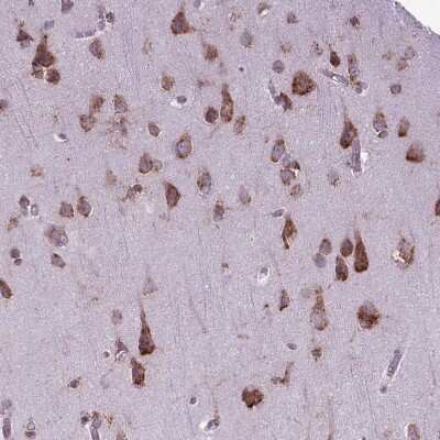 Immunohistochemistry-Paraffin: WDR83OS Antibody [NBP2-55905] - Staining of human Cerebral cortex shows moderate membranous and cytoplasmic positivity in neuronal cells.