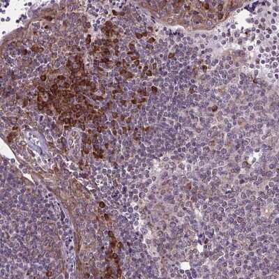 Immunohistochemistry-Paraffin: WDR83OS Antibody [NBP2-55905] - Staining of human Tonsil shows moderate membranous and cytoplasmic positivity in non-germinal center and squamous epithelial cells.