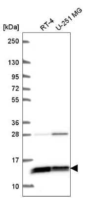 Western Blot: WDR83OS Antibody [NBP2-55905] - Western blot analysis in human cell line RT-4 and human cell line U-251 MG.