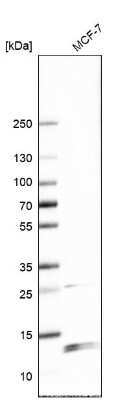 Western Blot: WDR83OS Antibody [NBP2-55905] - Analysis in human cell line MCF-7.