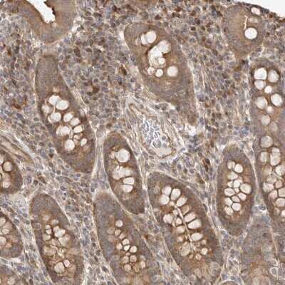 Immunohistochemistry-Paraffin: WDR85 Antibody [NBP1-86714] - Staining of human duodenum shows cytoplasmic positivity in glandular cells.