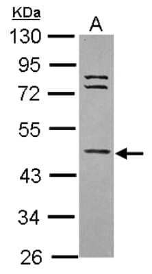 Western Blot: WDR85 Antibody [NBP2-20902] - Sample (30 ug of whole cell lysate) A: IMR32 10% SDS PAGE gel, diluted at 1:1000.