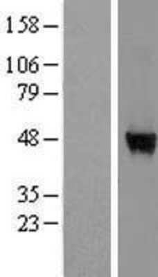 Western Blot: WDR85 Overexpression Lysate (Adult Normal) [NBL1-17833] Left-Empty vector transfected control cell lysate (HEK293 cell lysate); Right -Over-expression Lysate for WDR85.