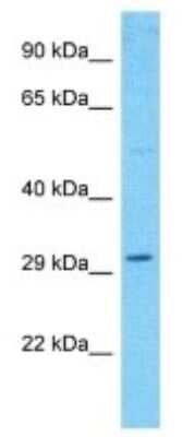 Western Blot: WDR86 Antibody [NBP3-09910] - Western blot analysis of WDR86 in 721_B Whole Cell lysates. Antibody dilution at 1.0ug/ml