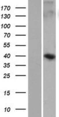 Western Blot: WDR86 Overexpression Lysate (Adult Normal) [NBP2-04721] Left-Empty vector transfected control cell lysate (HEK293 cell lysate); Right -Over-expression Lysate for WDR86.