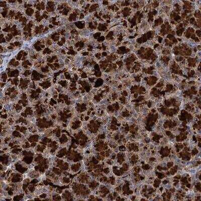 Immunohistochemistry-Paraffin: WDR88 Antibody [NBP1-90677] - Staining of human pancreas shows strong cytoplasmic positivity in exocrine glandular cells.