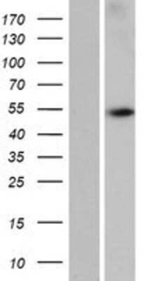 Western Blot: WDR88 Overexpression Lysate (Adult Normal) [NBP2-05135] Left-Empty vector transfected control cell lysate (HEK293 cell lysate); Right -Over-expression Lysate for WDR88.