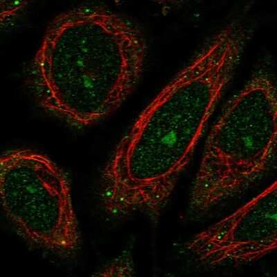 Immunocytochemistry/Immunofluorescence: WDR9 Antibody [NBP2-38169] - Immunofluorescent staining of human cell line SiHa shows localization to nucleoli & cytosol.
