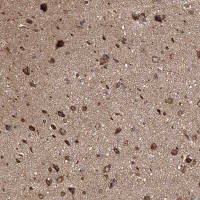 Immunohistochemistry: WDR9 Antibody [NBP2-38168] - Staining of human cerebral cortex shows moderate positivity in neuronal cells and glial cells.