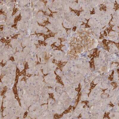 Immunohistochemistry: WDR9 Antibody [NBP2-38169] - Staining of human pancreas shows strong cytoplasmic and membranous positivity in pancreatic ducts.