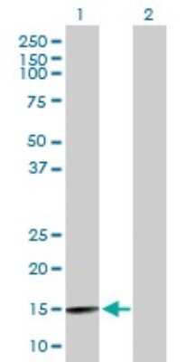 Western Blot: WDR9 Antibody [H00054014-B01P] - Analysis of BRWD1 expression in transfected 293T cell line by BRWD1 polyclonal antibody.  Lane1:BRWD1 transfected lysate(13.2 KDa). Lane2:Non-transfected lysate.