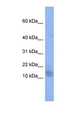 Western Blot: WDR9 Antibody [NBP1-54801] - Titration: 0.2-1 ug/ml, Positive Control: PANC1 cell lysate.