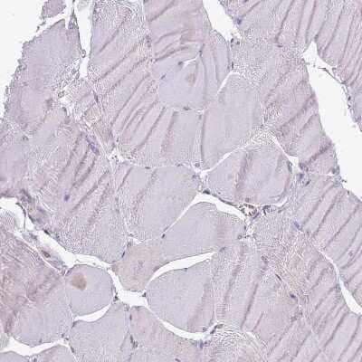 Immunohistochemistry-Paraffin WDR90 Antibody - BSA Free