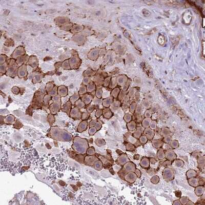 Immunohistochemistry-Paraffin WDR90 Antibody - BSA Free