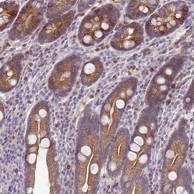 Immunohistochemistry-Paraffin WDR90 Antibody - BSA Free