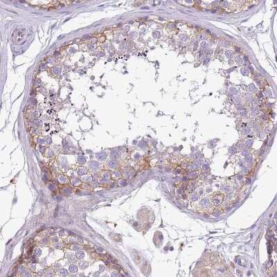 Immunohistochemistry-Paraffin WDR90 Antibody - BSA Free