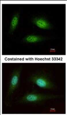 Immunocytochemistry/Immunofluorescence: WDR91 Antibody [NBP2-20903] - Immunofluorescence analysis of methanol-fixed HeLa, using antibody at 1:200 dilution.