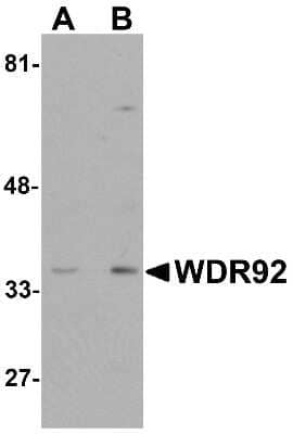 Western Blot WDR92 Antibody - BSA Free