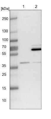 Western Blot: WDR92 Antibody [NBP1-92594] - Lane 1: NIH-3T3 cell lysate (Mouse embryonic fibroblast cells). Lane 2: NBT-II cell lysate (Rat Wistar bladder tumor cells).