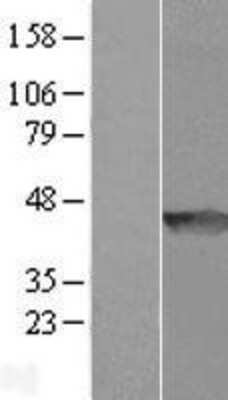 Western Blot WDR92 Overexpression Lysate