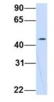 Western Blot: WDSOF1 Antibody [NBP1-70747] - Human Fetal Muscle, Antibody Dilution: 1.0 ug/ml.