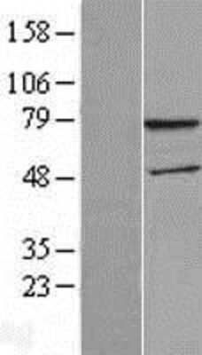 Western Blot: WDTC1 Overexpression Lysate (Adult Normal) [NBL1-17839] Left-Empty vector transfected control cell lysate (HEK293 cell lysate); Right -Over-expression Lysate for WDTC1.