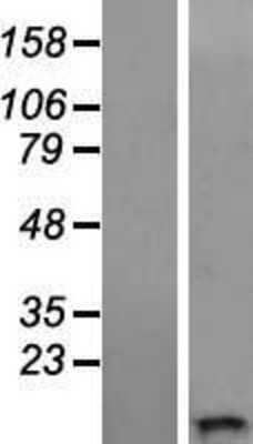 Western Blot WFDC11 Overexpression Lysate