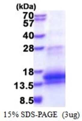 SDS-Page: WFDC12 Recombinant Protein [NBP2-51521] - 15% SDS Page (3 ug)