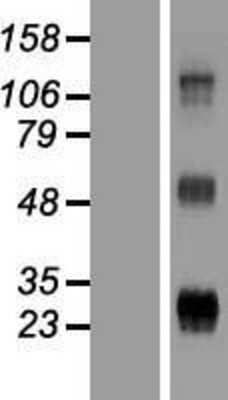 Western Blot: WFDC3 Overexpression Lysate (Adult Normal) [NBP2-05779] Left-Empty vector transfected control cell lysate (HEK293 cell lysate); Right -Over-expression Lysate for WFDC3.