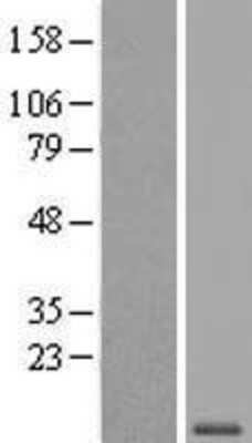 Western Blot: WFDC6 Overexpression Lysate (Adult Normal) [NBL1-17843] Left-Empty vector transfected control cell lysate (HEK293 cell lysate); Right -Over-expression Lysate for WFDC6.