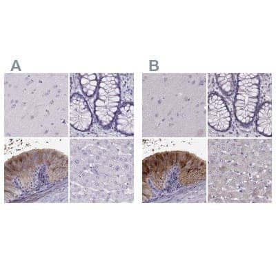 Immunohistochemistry-Paraffin: WFDC8 Antibody [NBP2-62608] - Staining of human cerebral cortex, colon, epididymis and liver using Anti-WFDC8 antibody NBP2-62608 (A) shows similar protein distribution across tissues to independent antibody NBP2-62671 (B).