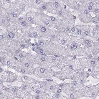 Immunohistochemistry-Paraffin: WFDC8 Antibody [NBP2-62608] - Staining of human liver.