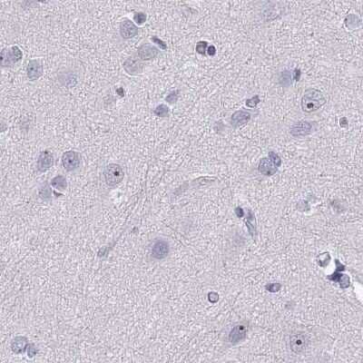 Immunohistochemistry-Paraffin: WFDC8 Antibody [NBP2-62608] - Staining of human cerebral cortex.