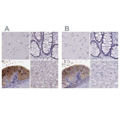 Immunohistochemistry-Paraffin: WFDC8 Antibody [NBP2-62671] - Staining of human cerebral cortex, colon, epididymis and liver using Anti-WFDC8 antibody NBP2-62671 (A) shows similar protein distribution across tissues to independent antibody NBP2-62608 (B).