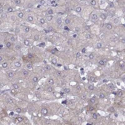 Immunohistochemistry-Paraffin: WFDC8 Antibody [NBP2-62671] - Staining of human liver.