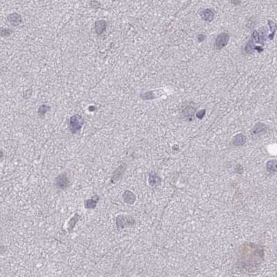 Immunohistochemistry-Paraffin: WFDC8 Antibody [NBP2-62671] - Staining of human cerebral cortex.