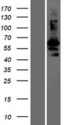 Western Blot GASP-1/WFIKKN2 Overexpression Lysate