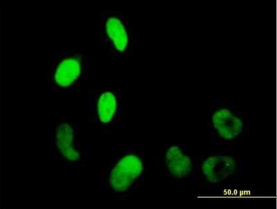 Immunocytochemistry/Immunofluorescence: WHSC2 Antibody [H00007469-B01P] - Analysis of purified antibody to WHSC2 on HeLa cell. (antibody concentration 10 ug/ml)