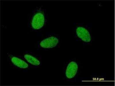 Immunocytochemistry/Immunofluorescence: WHSC2 Antibody [H00007469-B03P] - Analysis of purified antibody to WHSC2 on HeLa cell. Antibody concentration 10 ug/ml