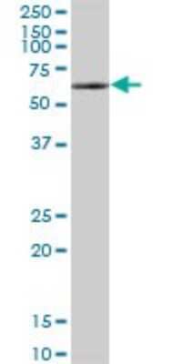 Western Blot: WHSC2 Antibody [H00007469-B01P] - Analysis of WHSC2 expression in Jurkat.