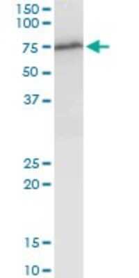Western Blot: WHSC2 Antibody [H00007469-B03P] - Analysis of WHSC2 expression in NIH/3T3.