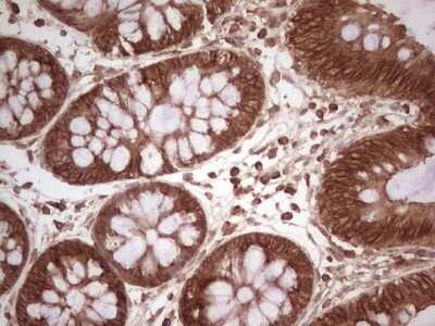 Immunohistochemistry: WIBG Antibody (OTI5E2) - Azide and BSA Free [NBP2-74868] - Analysis of Human colon tissue. (Heat-induced epitope retrieval by 1 mM EDTA in 10mM Tris, pH8.5, 120C for 3min)