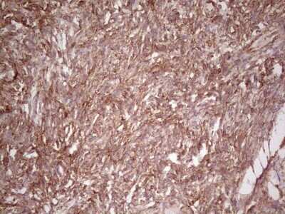 Immunohistochemistry: WIBG Antibody (OTI5E2) - Azide and BSA Free [NBP2-74868] - Analysis of Human Ovary tissue. (Heat-induced epitope retrieval by 1 mM EDTA in 10mM Tris, pH8.5, 120C for 3min)