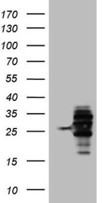 Western Blot: WIBG Antibody (OTI5E2) - Azide and BSA Free [NBP2-74868] - Analysis of HEK293T cells were transfected with the pCMV6-ENTRY control (Left lane) or pCMV6-ENTRY WIBG.