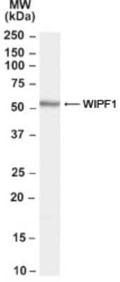 Western Blot: WIPF1/WIP Antibody [NB100-68147] - Analysis of WIPF1/WIP antibody using this antibody at 0.03 ug/ml in Human Tonsil. Primary incubation was 1 hour. Detected by chemiluminescence.
