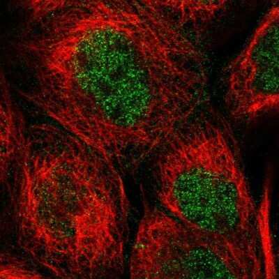 Immunocytochemistry/Immunofluorescence: WIPI2 Antibody [NBP1-88880] - Immunofluorescent staining of human cell line A-431 shows localization to nucleoplasm.