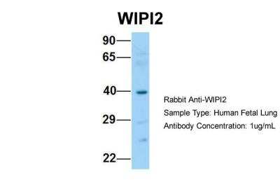 Western Blot: WIPI2 Antibody [NBP2-86382] - Host: Rabbit. Target Name: WIPI2. Sample Type: Human Fetal Lung. Antibody Dilution: 1.0ug/ml