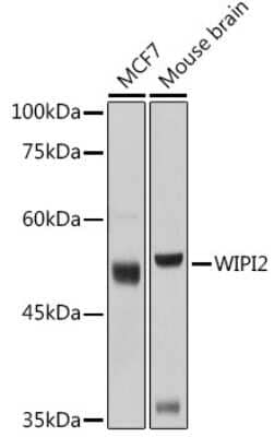 Western Blot: WIPI2 Antibody [NBP2-93646] - Western blot analysis of extracts of various cell lines, using WIPI2 antibody (NBP2-93646) at 1:1000 dilution. Secondary antibody: HRP Goat Anti-Rabbit IgG (H+L) at 1:10000 dilution. Lysates/proteins: 25ug per lane. Blocking buffer: 3% nonfat dry milk in TBST. Detection: ECL Basic Kit. Exposure time: 3s.