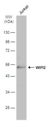 Western Blot: WIPI2 Antibody [NBP3-13110] - Various whole cell extracts (30 ug) was separated by 10% SDS-PAGE, and the membrane was blotted with WIPI2 antibody (NBP3-13110) diluted at 1:2000. The HRP-conjugated anti-rabbit IgG antibody (NBP2-19301) was used to detect the primary antibody.